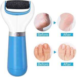 Electronic Foot Cleaner (Pedi Spin)